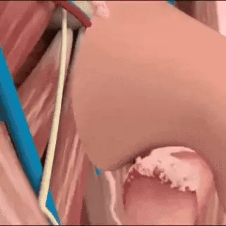 Erection in 2 minutes